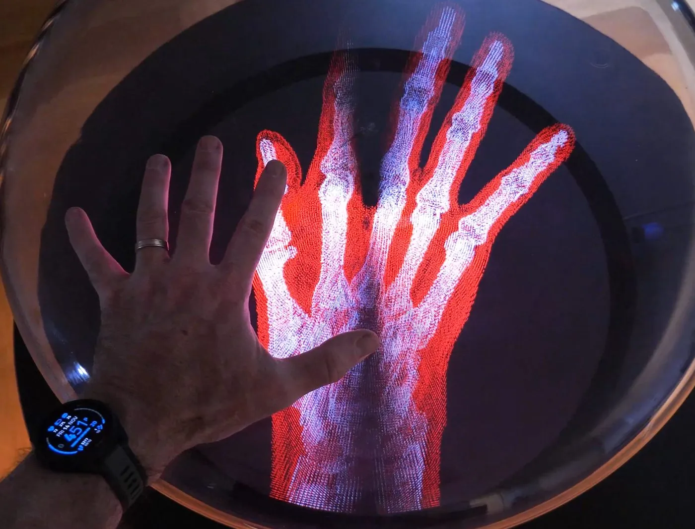 Medical on a Voxel Photonics volumetric display
